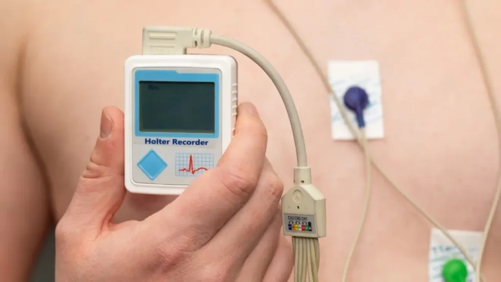 holter ecg fes